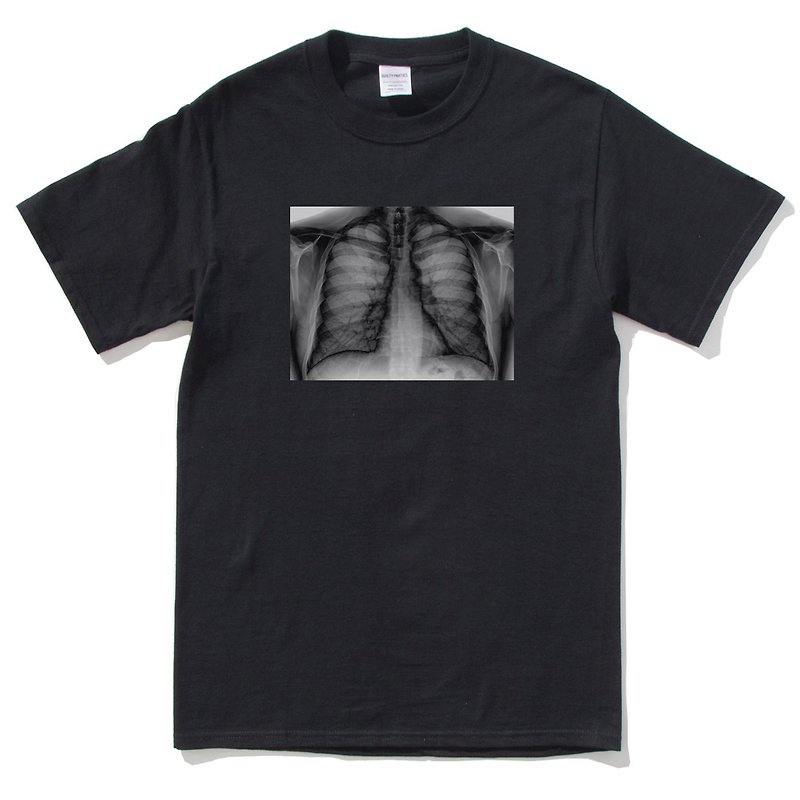 X-Ray Lungs 短袖T恤 黑色 肺部X光交换礼物圣诞设计文青照片趣味 - 男装上衣/T 恤 - 棉．麻 黑色